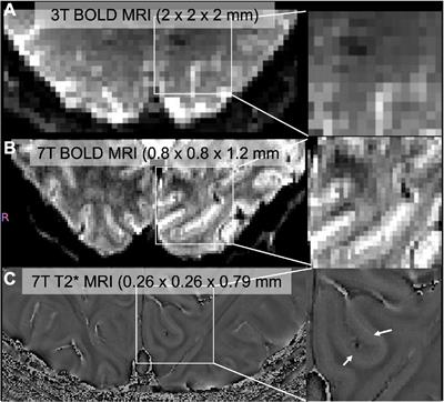 Laminar functional magnetic resonance imaging in vision research